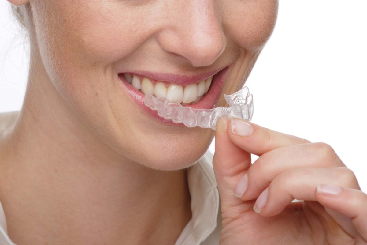 invisalign-new