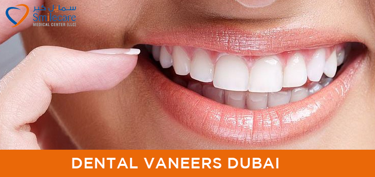 Dental-vaneer-dubai.jpg